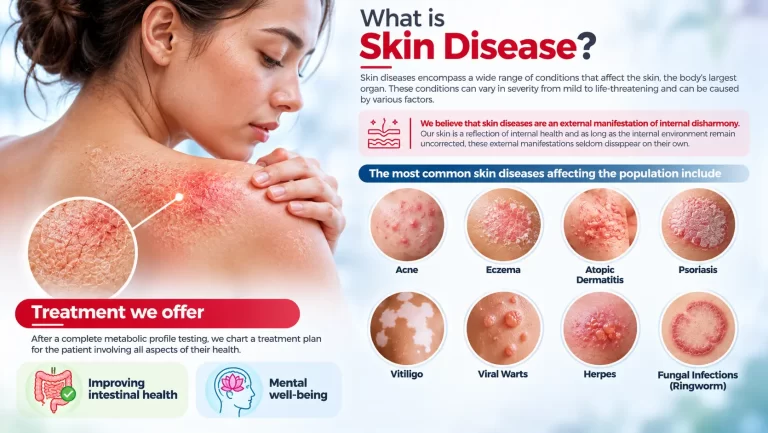 Understanding-Skin-Diseases